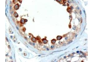 Immunohistochemistry (IHC) image for anti-Alstrom Syndrome 1 (ALMS1) (C-Term) antibody (ABIN2465390) (ALMS1 Antikörper  (C-Term))