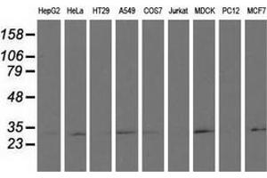 Western blot analysis of extracts (35 µg) from 9 different cell lines by using anti-RASD2 monoclonal antibody. (RASD2 Antikörper)