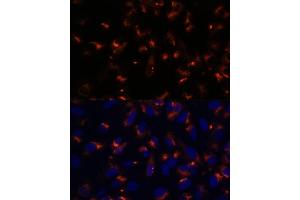 Immunofluorescence analysis of U-2 OS cells using CCDC47 antibody (ABIN7266438) at dilution of 1:100. (CCDC47 Antikörper  (AA 224-483))