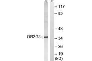 Western blot analysis of extracts from Jurkat cells, using OR2G3 Antibody. (OR2G3 Antikörper  (AA 61-110))