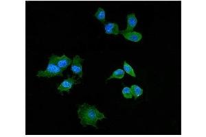 IF analysis of Elafin/Skalp using antiElafin/Skalp antibody (ABIN4886694). (PI3 Antikörper  (AA 61-117))