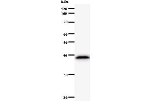 Western Blotting (WB) image for anti-Asparaginyl-tRNA Synthetase (NARS) antibody (ABIN932996)