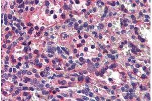 Human Spleen: Formalin-Fixed, Paraffin-Embedded (FFPE) (Septin 8 Antikörper  (AA 1-259))