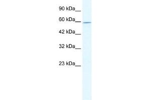 WB Suggested Anti-DDX47 Antibody Titration:  2. (DDX47 Antikörper  (N-Term))