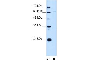 WB Suggested Anti-CDT1 Antibody Titration:  0.