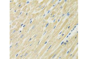 Immunohistochemistry of paraffin-embedded Rat heart using SLC19A1 Polyclonal Antibody at dilution of 1:100 (40x lens). (SLC19A1 Antikörper)