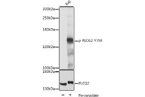 Western blot analysis of extracts of Raji cells, using Phospho-PLC gamma 2 (PLCG2)-Y759 antibody (ABIN7269341) at 1:2000 dilution or PLC gamma 2 (PLCG2) antibody (ABIN3023144, ABIN3023145, ABIN3023146 and ABIN6219411). (Phospholipase C gamma 2 Antikörper  (pTyr759))