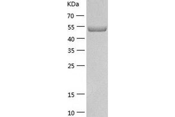 TANK Protein (AA 1-448) (His tag)