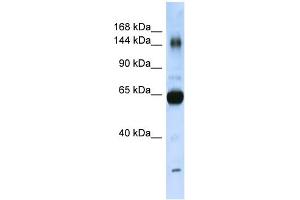 WB Suggested Anti-COL11A2 Antibody Titration:  0. (COL11A2 Antikörper  (N-Term))
