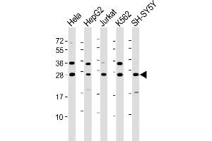 All lanes : Anti-HSD17B10 Antibody (N-Term) at 1:8000 dilution Lane 1: Hela whole cell lysate Lane 2: HepG2 whole cell lysate Lane 3: Jurkat whole cell lysate Lane 4: K562 whole cell lysate Lane 5: SH-SY5Y whole cell lysate Lysates/proteins at 20 μg per lane.