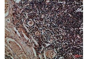Immunohistochemical analysis of paraffin-embedded Human-tonsil, antibody was diluted at 1:100 (KIR2DL5A Antikörper  (AA 31-80))