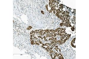 IHC analysis of PTBP2 using anti-PTBP2 antibody (ABIN7599453).
