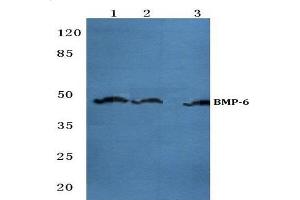 Western blot (WB) analysis of BMP-6 antibody  at 1/500 dilution. (BMP6 Antikörper)