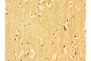 Immunohistochemistry of paraffin-embedded human brain tissue using ABIN7157217 at dilution of 1:100 (Kallikrein 6 Antikörper  (AA 22-244))