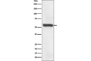 Western blot analysis of 58K Golgi protein expression in human fetal liver lysate.