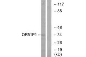 Western blot analysis of extracts from Jurkat cells, using OR51D1 Antibody. (OR51D1 Antikörper  (AA 33-82))