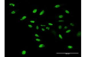 Immunofluorescence of purified MaxPab antibody to WDR4 on HeLa cell. (WDR4 Antikörper  (AA 1-412))