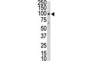 Western blot analysis of DDR2 antibody and HL-60 lysate. (DDR2 Antikörper  (AA 290-320))