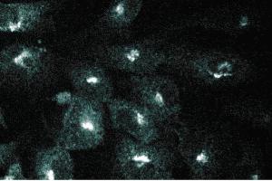 Immunofluorescence staining of human endothelial cells.