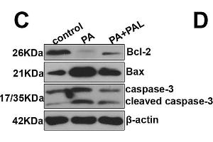 Effect of PAL on cell apoptosis in palmitate (PA) treated INS-1 cells. (Bcl-2 Antikörper)