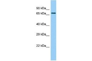 Host: Rabbit Target Name: BTBD18 Sample Type: 721_B Whole Cell lysates Antibody Dilution: 1. (BTBD18 Antikörper  (C-Term))