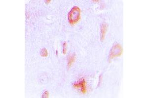Immunohistochemical analysis of Cytochrome P450 4X1 staining in human brain formalin fixed paraffin embedded tissue section. (CYP4X1 Antikörper  (Center))
