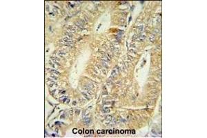 Immunohistochemistry (Paraffin-embedded Sections) (IHC (p)) image for anti-Hydroxyprostaglandin Dehydrogenase 15-(NAD) (HPGD) (AA 184-212), (C-Term) antibody (ABIN390765)
