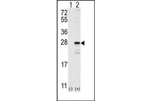 Image no. 1 for anti-GTPase NRas (NRAS) (C-Term) antibody (ABIN360039) (GTPase NRas Antikörper  (C-Term))