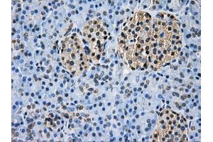 Immunohistochemical staining of paraffin-embedded Ovary tissue using anti-GBE1 mouse monoclonal antibody. (GBE1 Antikörper)