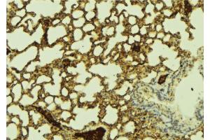 ABIN6274431 at 1/100 staining Mouse lung tissue by IHC-P.