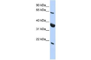 Western Blotting (WB) image for anti-Signal Recognition Particle Receptor (Docking Protein) (SRPR) antibody (ABIN2458501)