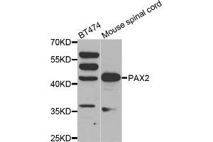 Western blot analysis of extracts of various cell lines, using PAX2 antibody (ABIN1874046) at 1:500 dilution. (PAX2A Antikörper)