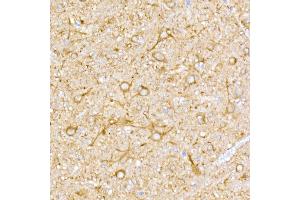 Immunohistochemistry of paraffin-embedded rat brain using NgR3 Rabbit mAb (ABIN7269932) at dilution of 1:50 (40x lens). (RTN4RL1 Antikörper)