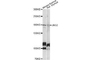 Western blot analysis of extracts of various cell lines, using JAG2 antibody (ABIN6291337) at 1:1000 dilution. (JAG2 Antikörper)