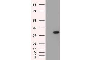 Image no. 1 for anti-Acetyl-CoA Acetyltransferase 2 (ACAT2) antibody (ABIN1496401) (ACAT2 Antikörper)