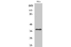 Western Blotting (WB) image for anti-Arginase, Type II (ARG2) (C-Term) antibody (ABIN3180496) (ARG2 Antikörper  (C-Term))