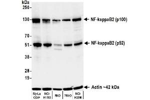 Western Blotting (WB) image for anti-NF-KappaB2 (/p52) (AA 1-50) antibody (ABIN7795782)