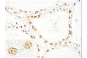 Immunohistochemistry (IHC) image for anti-LUC7-Like 3 (LUC7L3) (AA 1-50) antibody (ABIN7448489)
