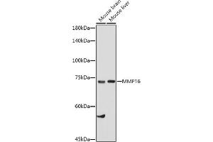 Western blot analysis of extracts of various cell lines, using MMP16 antibody (ABIN6132356, ABIN6143906, ABIN6143907 and ABIN6214654) at 1:1000 dilution.