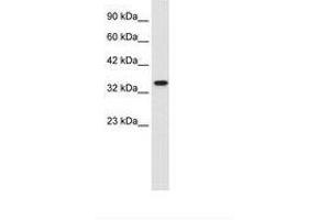 Image no. 1 for anti-Zinc Finger Protein 2 (ZNF2) (AA 124-173) antibody (ABIN202176) (ZNF2 Antikörper  (AA 124-173))