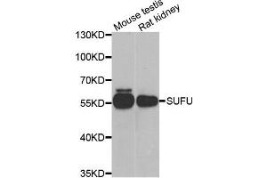 Western blot analysis of extracts of mouse testis and rat kidney cell lines, using SUFU antibody.