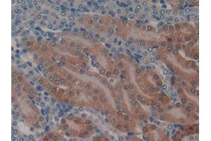 DAB staining on IHC-P; Samples: Mouse Kidney Tissue (GSTA1 Antikörper  (AA 2-223))
