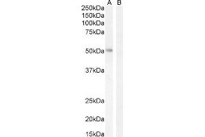 Western Blotting (WB) image for anti-Lymphoid Enhancer-Binding Factor 1 (LEF1) (Internal Region) antibody (ABIN185607)