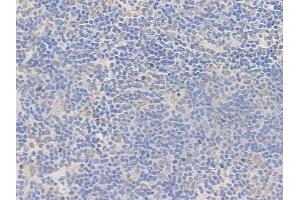 ABIN7095687 and ABIN7099749 at 1/100 staining human normal tonsil tissue by IHC-P. (FEZF2 Antikörper)
