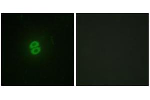 Immunofluorescence analysis of A549 cells, using CD253 antibody.