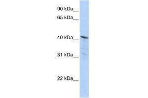 WB Suggested Anti-HDAC11 Antibody Titration:  0. (HDAC11 Antikörper  (Middle Region))