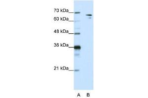 WB Suggested Anti-SF1  Antibody Titration: 1. (Splicing Factor 1 Antikörper  (N-Term))