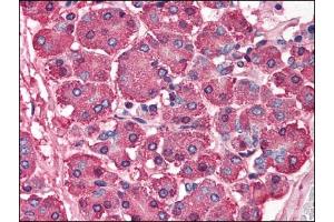 Image no. 1 for anti-SKI Proto-Oncogene (SKI) (N-Term) antibody (ABIN303247) (SKI Antikörper  (N-Term))