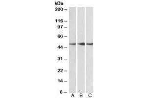 Western blot testing of human cerebellum [A], mouse [B] and rat [C] brain lysate with PPP2R5E antibody at 0. (PPP2R5E Antikörper)