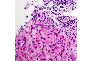 Immunohistochemistry (IHC) image for anti-NADH Dehydrogenase (Ubiquinone) 1 beta Subcomplex, 9, 22kDa (NDUFB9) (Center) antibody (ABIN7301050)